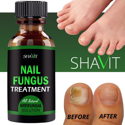 ANTI FUNGAL TREATMENT EXTRA STRENGTH TOENAIL