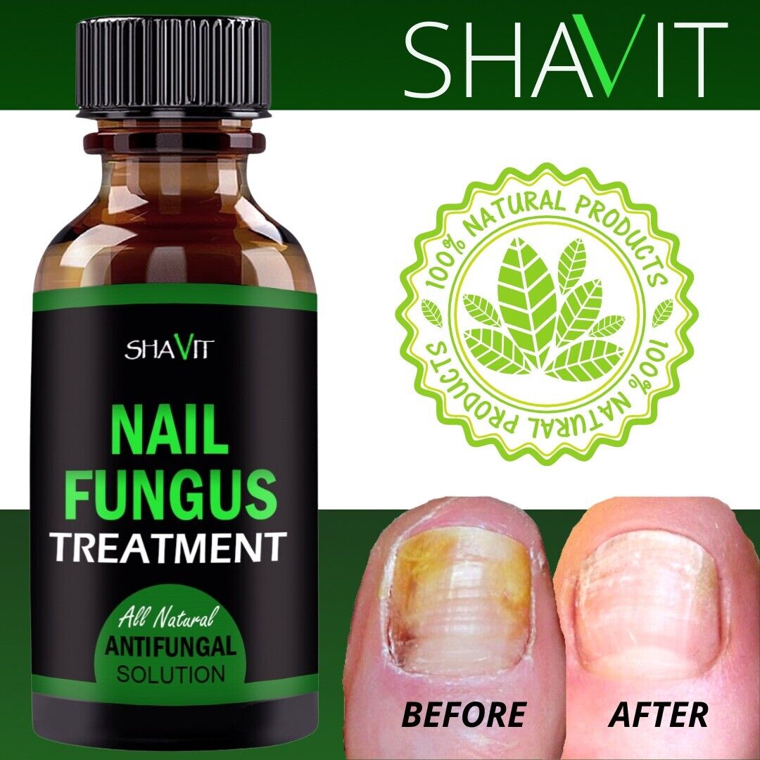 ANTI FUNGAL TREATMENT EXTRA STRENGTH TOENAIL