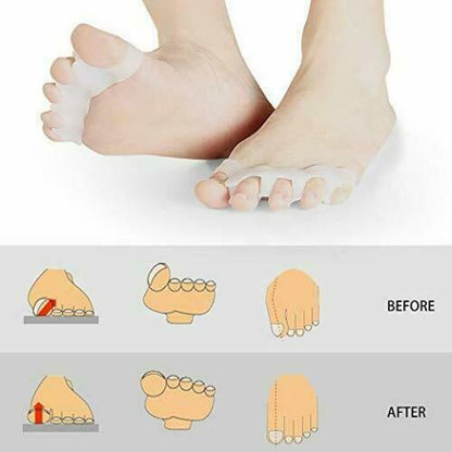 2 Toe Separators,Toes Spacer Bunion Corrector