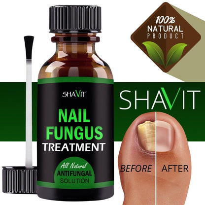 ANTI FUNGAL TREATMENT EXTRA STRENGTH TOENAIL