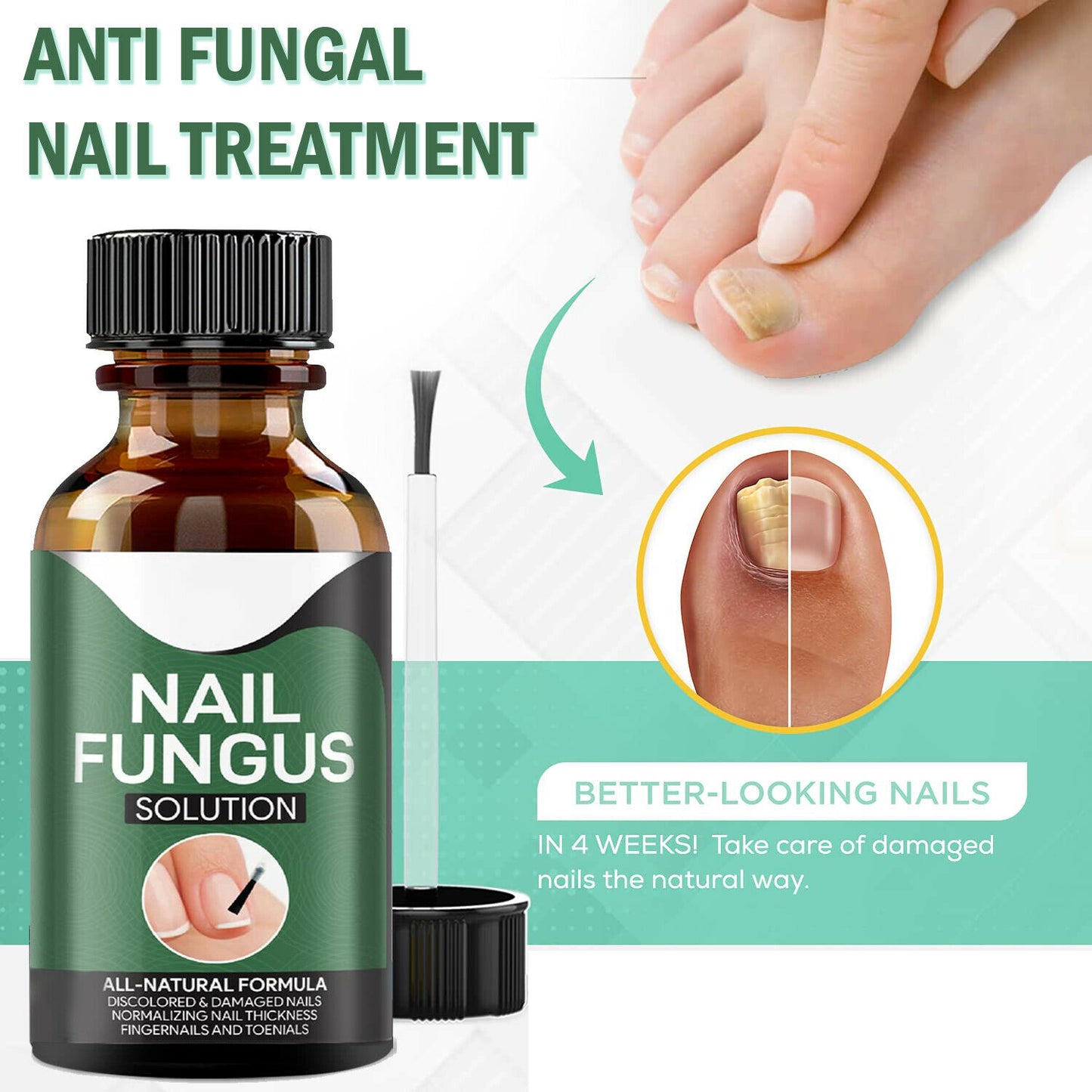 Anti Fungal Nail Treatment Nail Finger Toe Fungus Onychomycosis Remover