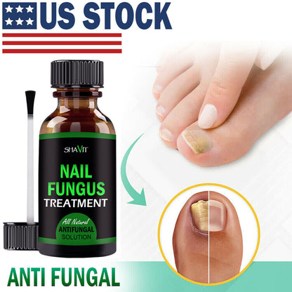 ANTI FUNGAL TREATMENT EXTRA STRENGTH TOENAIL