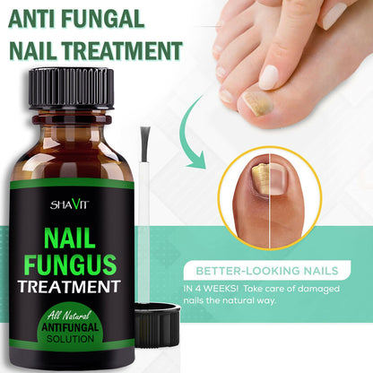 ANTI FUNGAL TREATMENT EXTRA STRENGTH TOENAIL