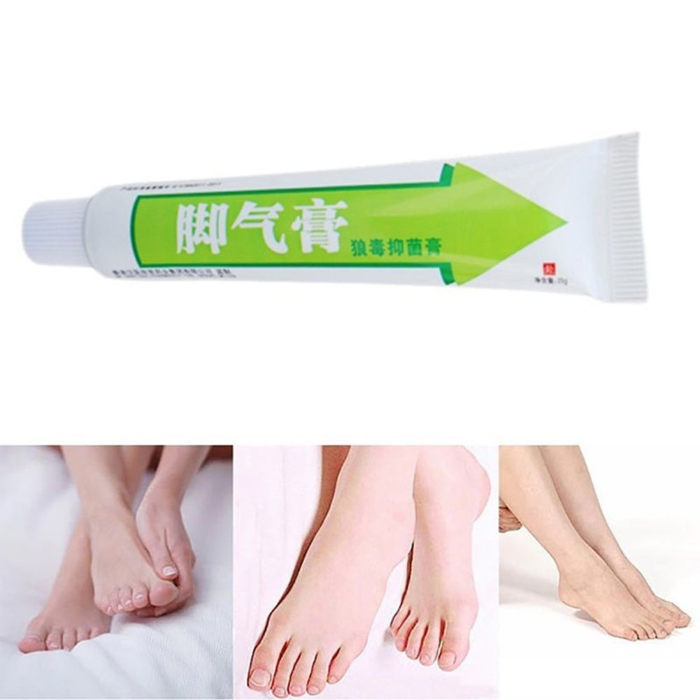 25g Crema para el cuidado de los pies Ampollas con picazón de atleta Peeling Beriberi Pomada para pies malos