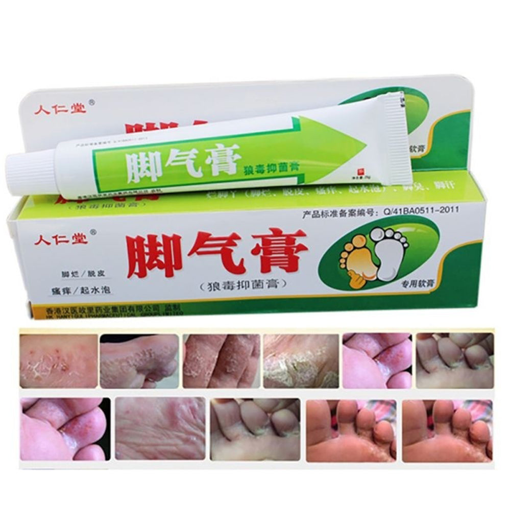 25g Foot Care Cream Athlete's Itch Blisters Peeling Beriberi Bad Feet Ointment